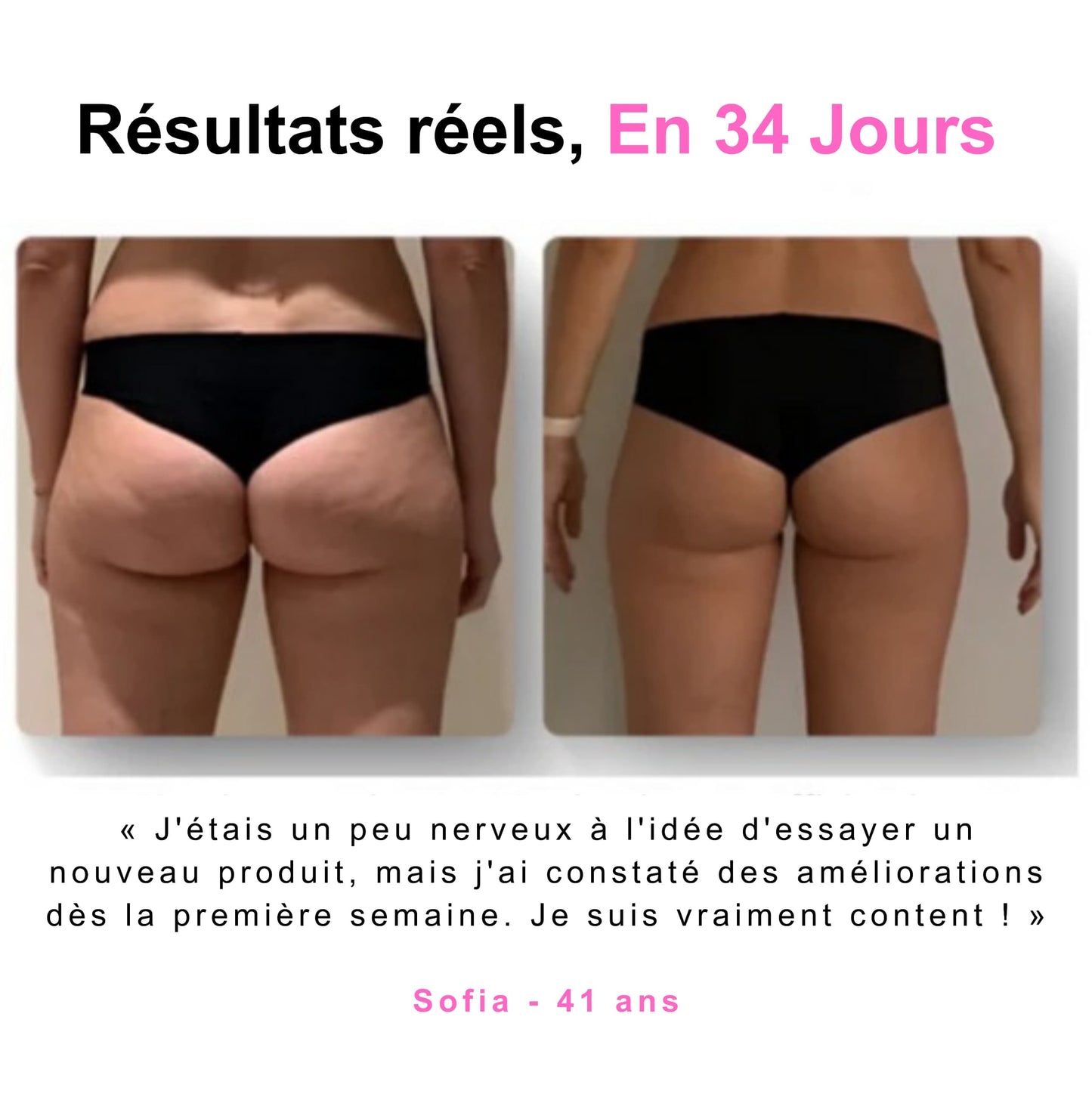 Masseur anti-cellulite Trendora™